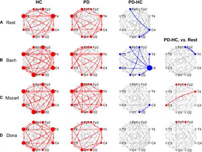 Effective Connectivity During Rest and Music Listening: An EEG Study on Parkinson’s Disease